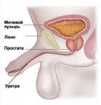 Уретрит